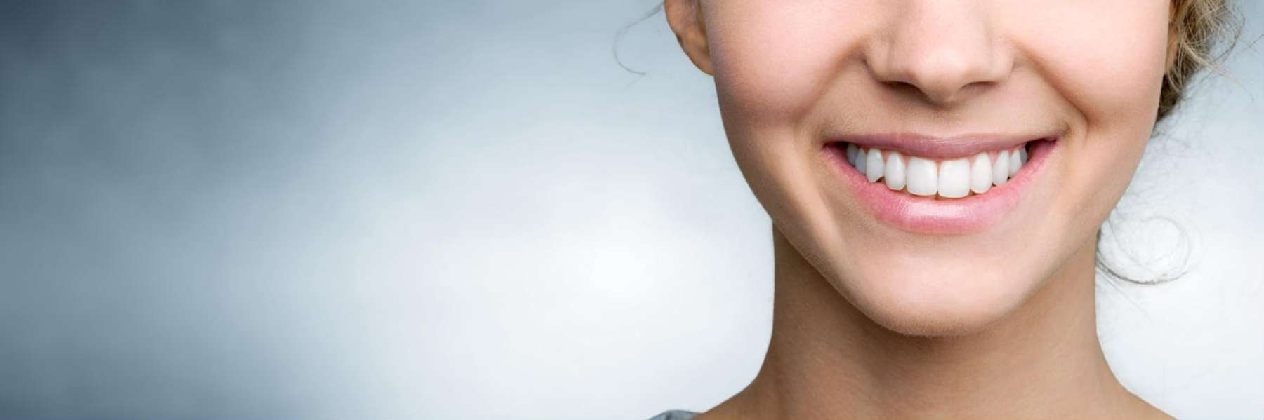 Composite Bonding | Dentist